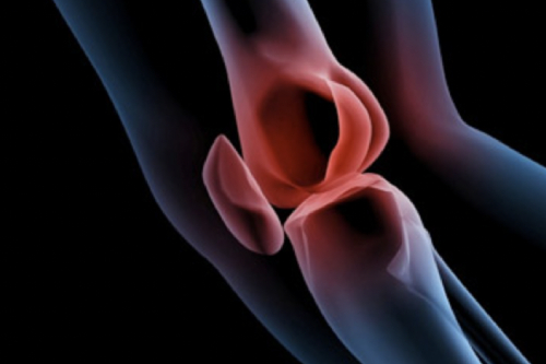 Reconstrucción de Ligamento Cruzado